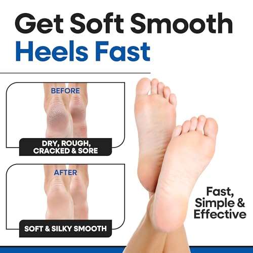 Moisturizing Socks for Women & Men | Aloe Vera Cracked Heel Treatment | Foot Callus Remover | Aloe Socks for Cracked Heels & Dry Cracked Feet | Lotion Infused Gel Heel Socks (Fits Most - 2 Pairs)