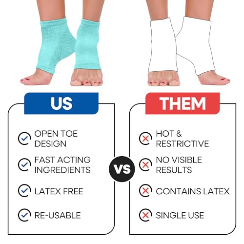 Moisturizing Socks for Women & Men | Aloe Vera Cracked Heel Treatment | Foot Callus Remover | Aloe Socks for Cracked Heels & Dry Cracked Feet | Lotion Infused Gel Heel Socks (Fits Most - 2 Pairs)