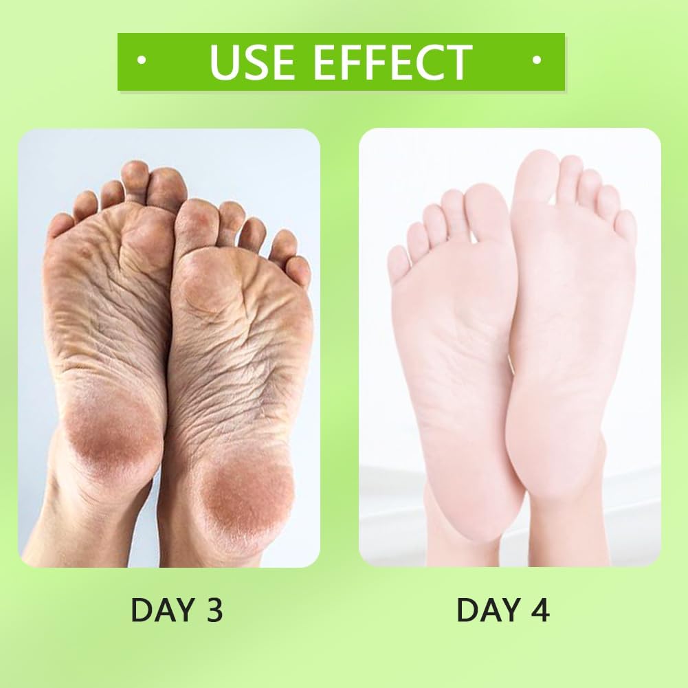 5 PCS Jelly Pedicure Foot Soak Packets Foot Soak Salts For Feet Tired Foot Odor Nail Discoloration Feet Softens Calluses Pedicure Foot Gel