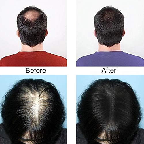 Hair Fibers Hair Building Fibers 100% Undetectable Hair Fuller Thicker,Instantly Cover Sparse Hair 25g/0.88oz (lightgold)