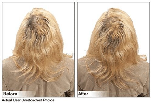 Hair Building Fibers Instantly Conceal Thinning Hair and Bald Spots for Men & Women (Large 28 Grams Bottle) - Undetectable, Washes Away, For All Hair Types, No Animal Byproducts (Medium Brown)