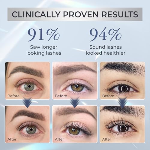 Abera Misan Eyelash Growth Serum β Natural Lash Booster with Red Ginseng, Biotin & Omega 3-6-9 β Fuller, Longer, Thicker Lashes β Safe for Sensitive Eyes (1 Box)