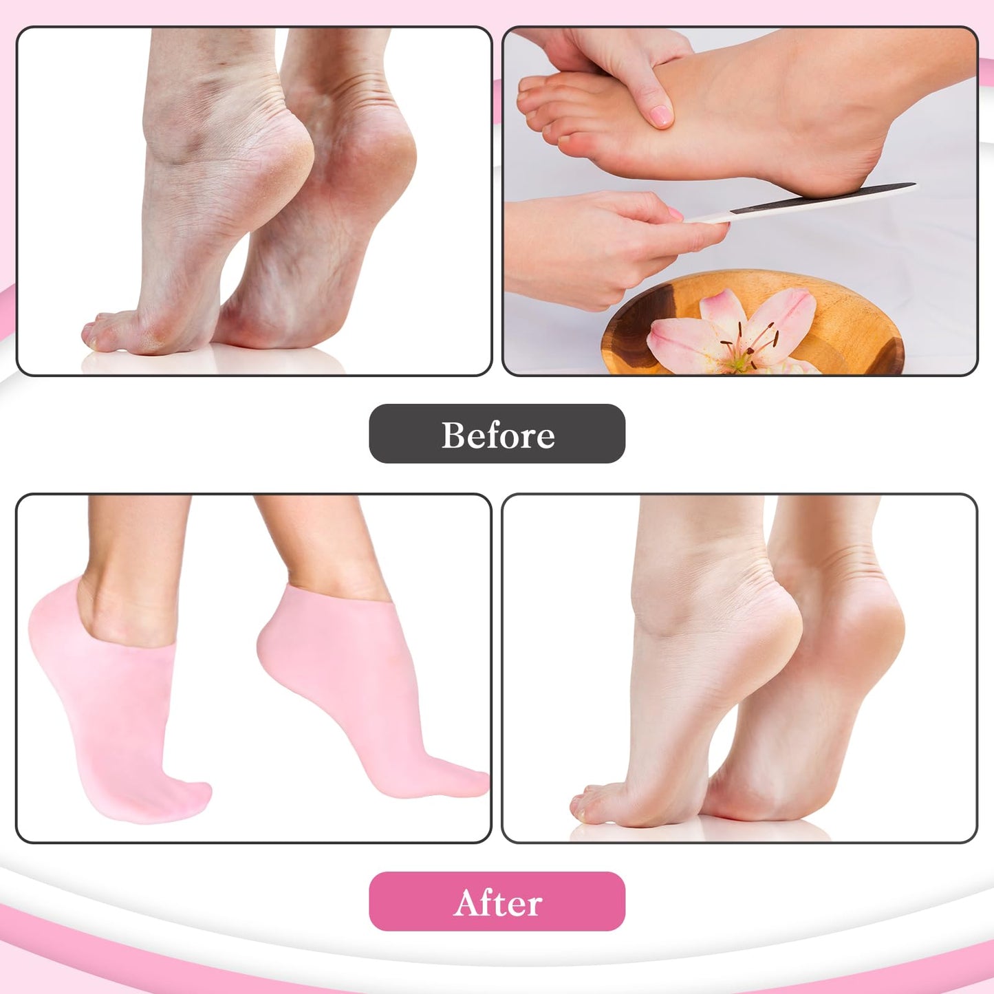 Sibba 2 Pairs Silicone Moisturizing Gloves and Socks, Spa Gel Hydrating Gloves for Overnight Bedtime Heal Eczema Sleeping Lotion Hand Treatment Gloves Socks Repair Rough Cracked Dry Chapped Skin