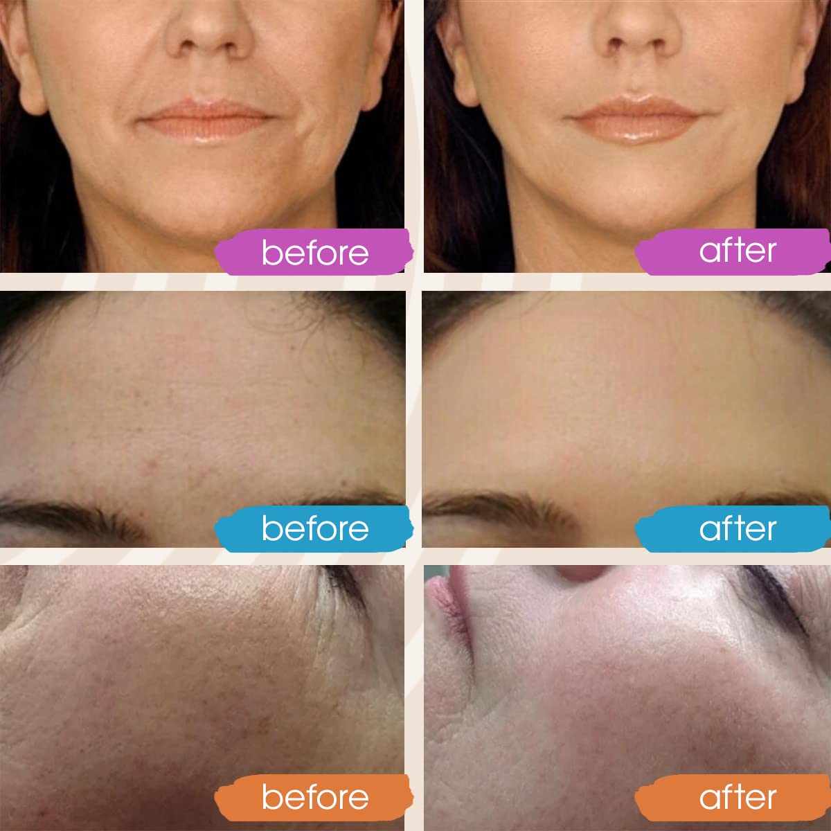 GLEOW Retinol Serum for Face, Vitamin C with Hyaluronic Acid Face Serum for Women and Men, Glow Skin Care Set Targets Appearance of Uneven Skin Tone and Dryness 3x2 oz