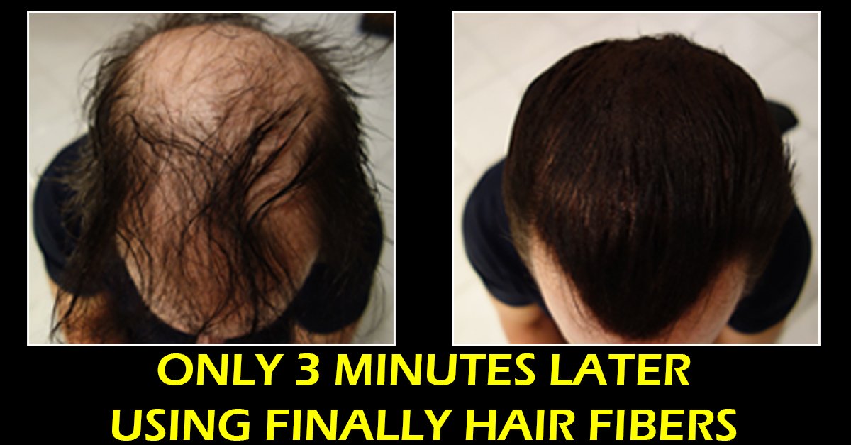Hair Building Fiber - 28g Bottle & 120ml 4.1 Oz. Bottle of Fiber Lock Spray. Thickening and Covering Thin Hair Loss (Dark Salt & Pepper - Special Soft Black White Mix)