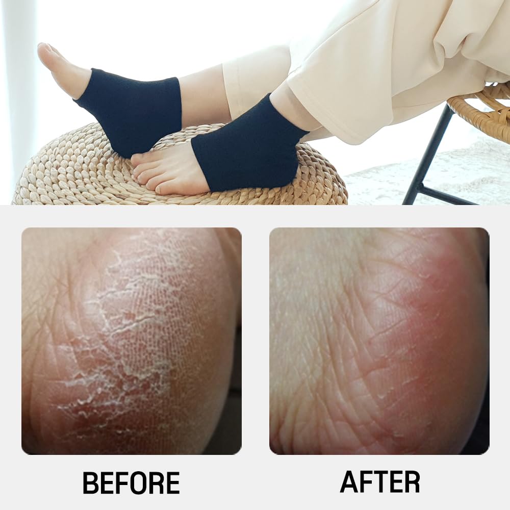 Moisturizing Gel Heel Socks to Repair Dry Cracked Heel - Soften, Soothe, and Revitalize Your Feet, for Men and Women (White, 1 Pair)