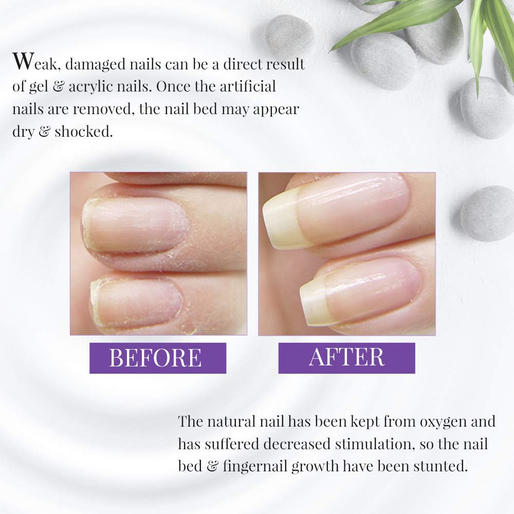 Nail Tek Xtra 4 Ridge Filling Nail Strengthener Base Coat, Nail Polish Repair Treatment for Weak and Damaged Nails, 0.5 oz, 1-Pack