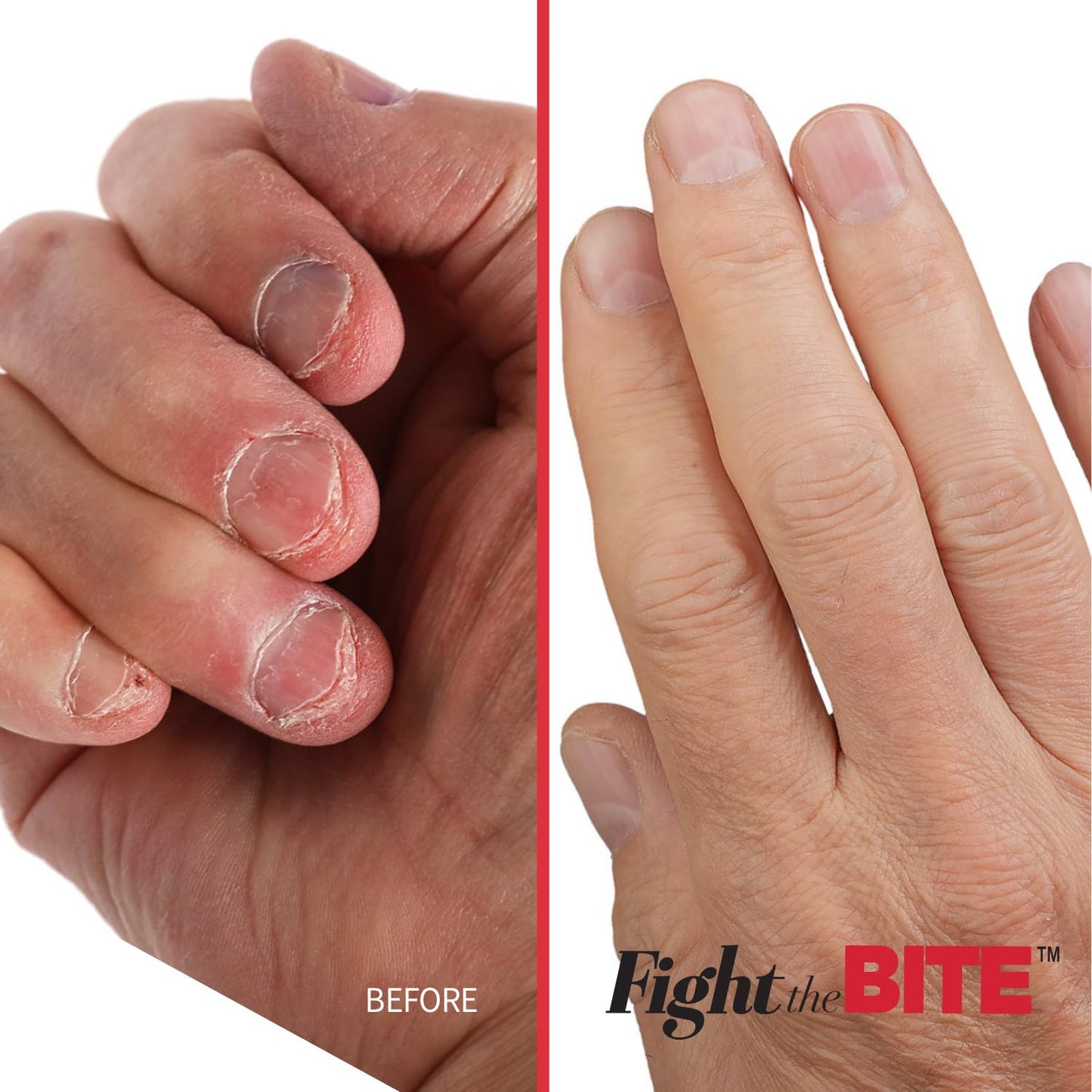 Cuccio Fight The Bite - Clear No Bite Nail Polish for Women & Men - Bitter Nail Polish to Deter Nail Biting - Promote Healthy Nail Growth - 0.50 Fl. Oz.