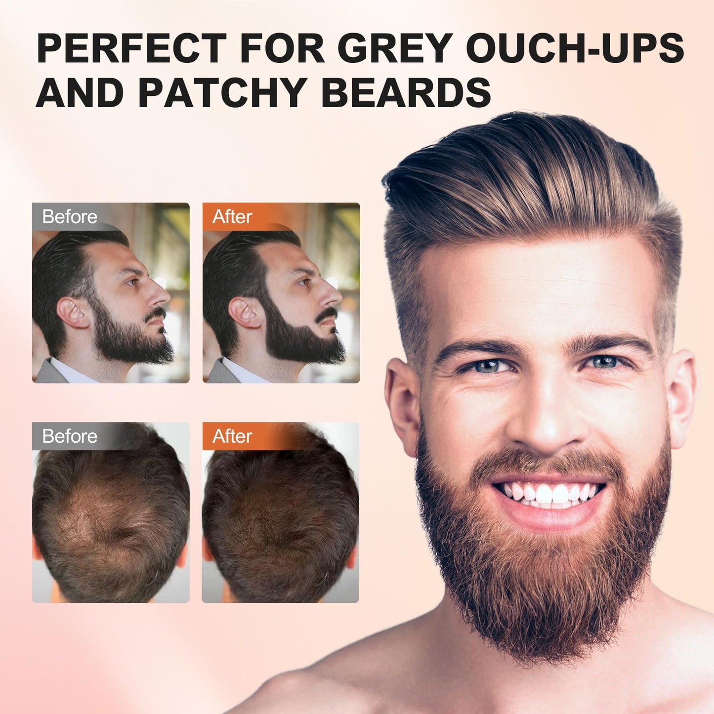 Acosexy Root Touch Up Powder - Instant Gray Hair Coverage for Hairline, Eyebrows, Men's Beard, and Bald Spots
