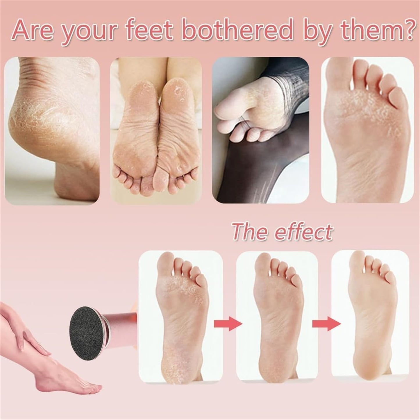 Dermavr Electric Foot Callus Remover for Women, Foot Scrubber File Smooth Wand with 60 Sanding Pads, Pedicure Tools for Feet for Heel Cracked Heels-Black