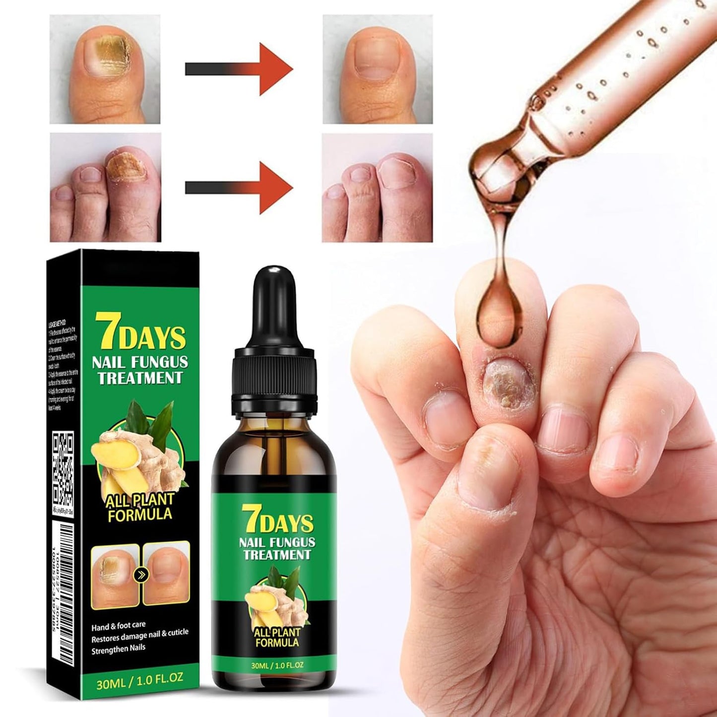 7days Nail Treatment, Ginger Nail Treatment,Nail Support Nail Care,Ginger Nail Growth Serum, Ginger Cuticle Care Oil for Nails (3PCS)