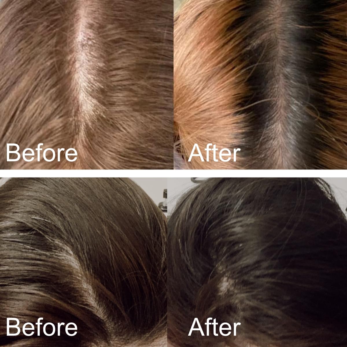 Aphrona® Advanced Hair Growth System 272 HairPro for Men and Women I For Mild to Moderate Hair Loss I Rechargeable Laser Cap for Hair Regrowth I Clinically Proven I FDA Cleared for Men and Women