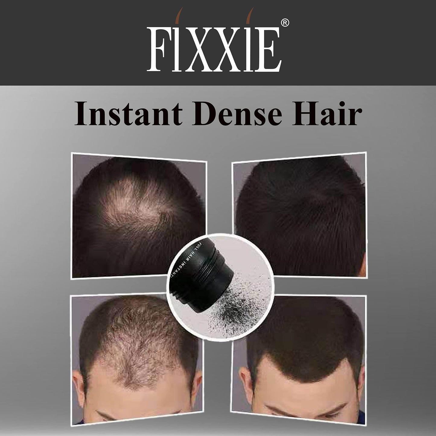 FIXXIE Hair Fibers DARK BROWN for Thinning Hair 27.5g Bottle, Hair Fibre Concealer for Hair Loss for Men and Women, Naturally Thicker Looking Hair with Keratin Hair Fibres