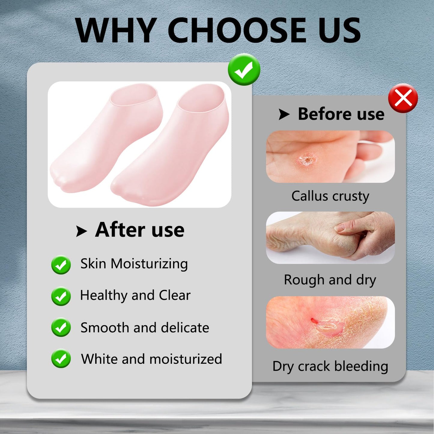 4 Pair Silicone Moisturizing Socks Gloves Set, Gel Socks for Dry Cracked Feet Women Men, Lotion Aloe Spa Pedicure Socks for Foot Softening Care, Silicone Hand and Feet Gloves (Nude & Pink)