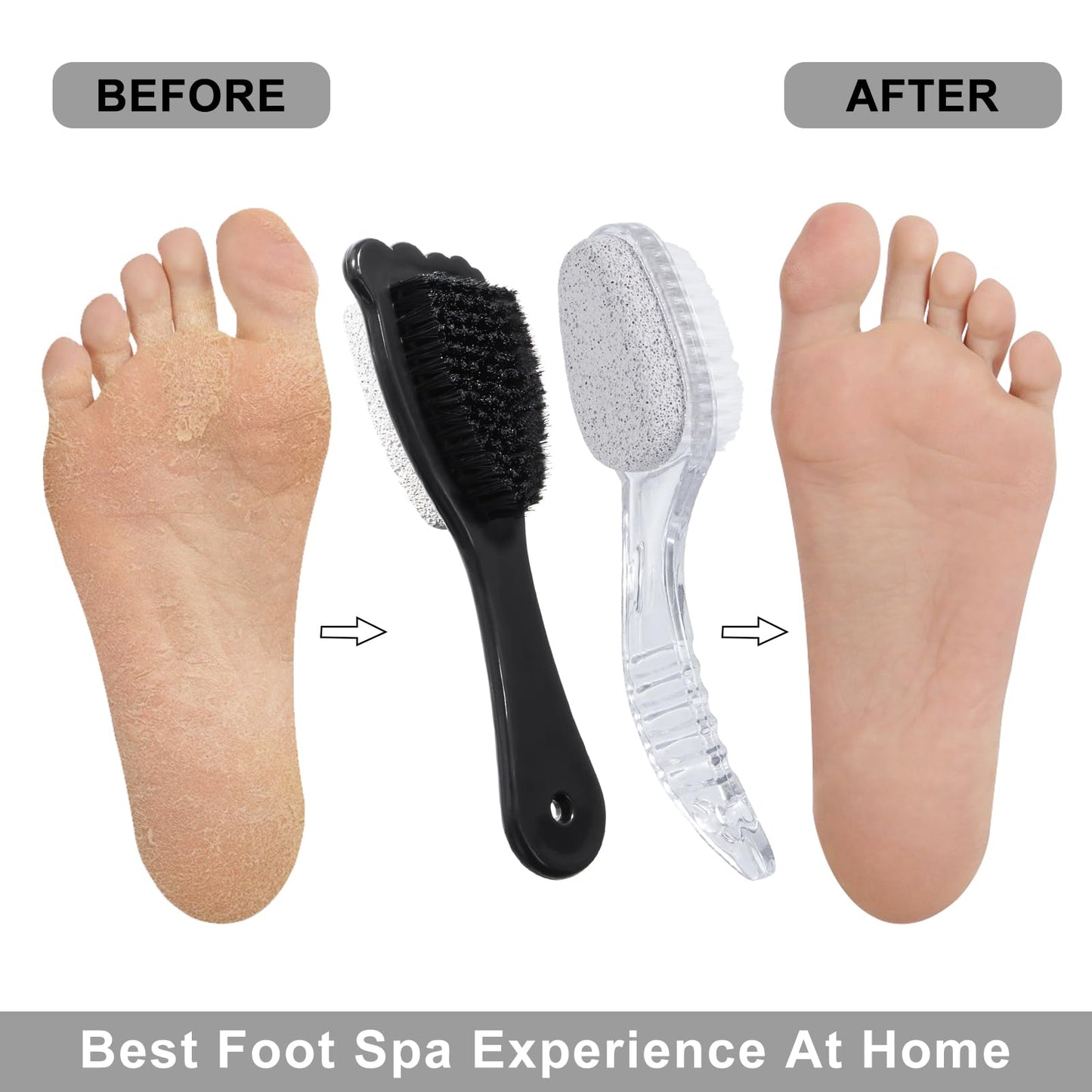 4 Packs Foot Pumice Stone Brush Callus Remover, Beomeen 2 in 1 Foot Shower Pedicure Scrubber with Handle, Foot File with Dense Bristles for Deep Cleansing and Exfoliation, Dry Skin Removal