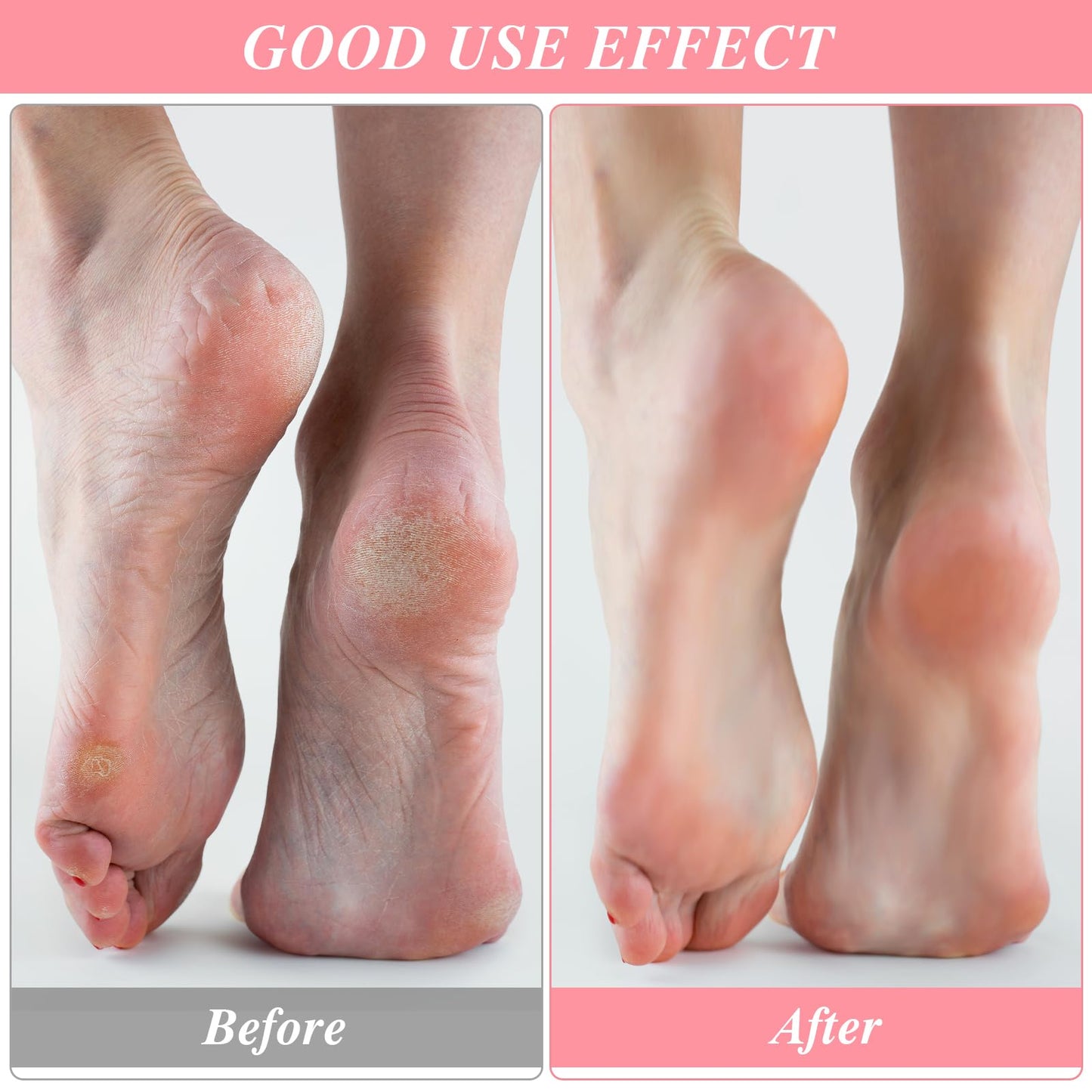 3Pairs Aloe Socks Moisturizing Spa Socks Sleeping Fuzzy Socks for Dry Feet Overnight, Non Slip Coral Fleece Lotion Socks Women Spa Pedicure Foot Care Socks for Repairing Dry Feet,Cracked Heel