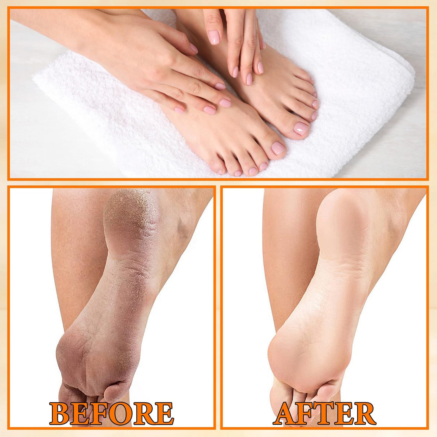 2PCS Foot Peeling Spray Orange Oil,Exfoliating Foot Spray for Remove Dead Skin,Hydrating Foot Care Spray,Peel Off Spray for Calluses & Dry Toe Cracked Rough,Quickly Moisturizing & Nourishing Feet