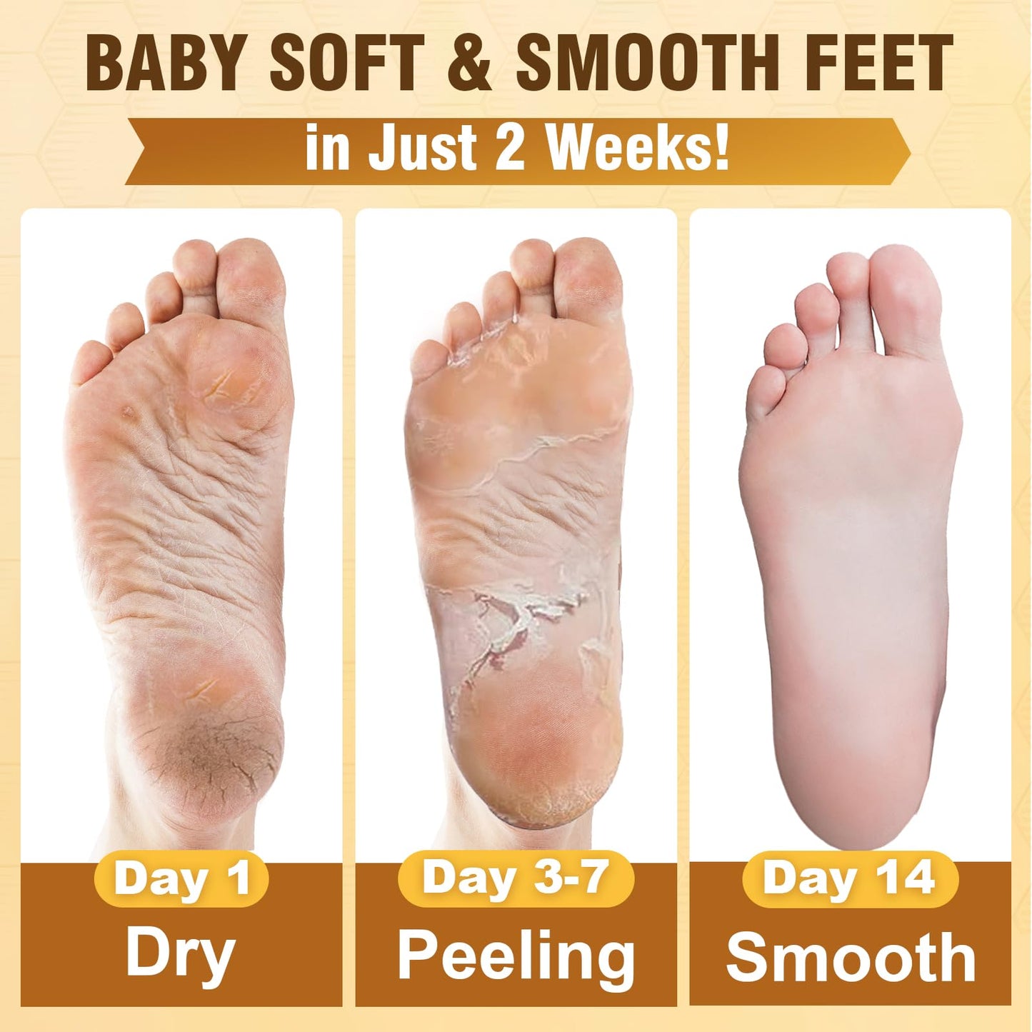 6 Pack Foot Peel Mask Set: 3 Effective Exfoliating Foot Masks for Intensive Callus & Dead Skin Removal + 3 Deep Moisturizing Foot Masks to Treat Dry, Cracked Feet, Milk & Honey Infused
