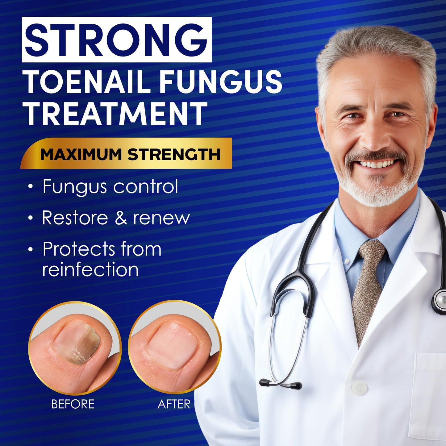 2 Bottle Toenail Fungus Treatment Extra Strength, 25% Undecylenic Acid, Tea Tree Oil, Toe Nail Fungus Treatments, Toe Fungus Treatment for Toenail