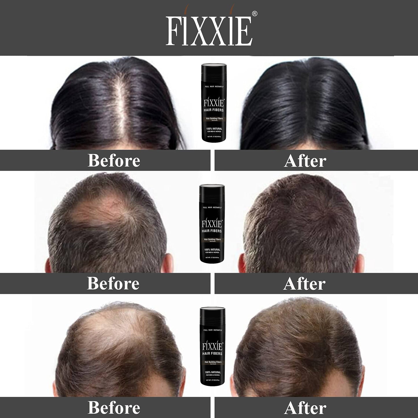 FIXXIE Hair Fibers DARK BROWN for Thinning Hair 27.5g Bottle, Hair Fibre Concealer for Hair Loss for Men and Women, Naturally Thicker Looking Hair with Keratin Hair Fibres
