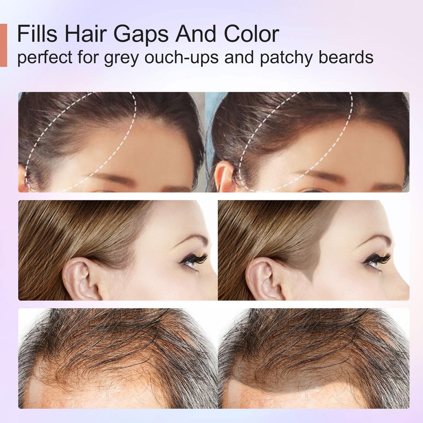 Acomler Instantly Root Touch Up Hairline Shadow Powder,Root Cover Up Hair Powder,Dark Brown for Thinning Hair, Grey Hair Coverage Hair Powder for Womem with Eyebrows,Beard Line,Bald Spots (Dark Brown)