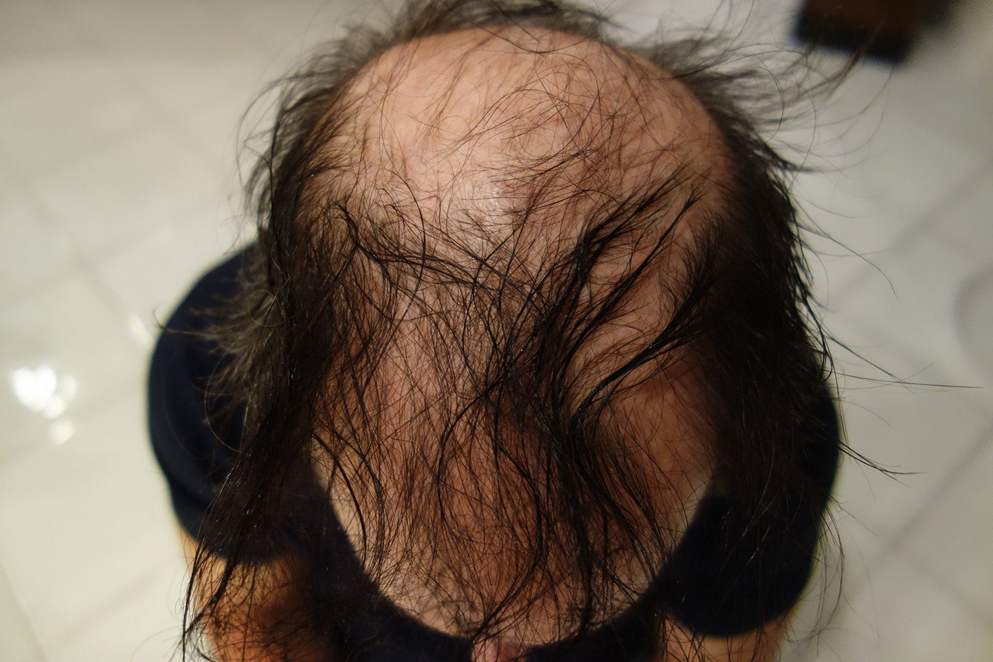 Hair Building Fibers 57 Grams. Highest Grade Refill That You Can Use for Your Bottles From Competitors Like Toppik?, Xfusion?, Miracle Hair? (Light Brown)