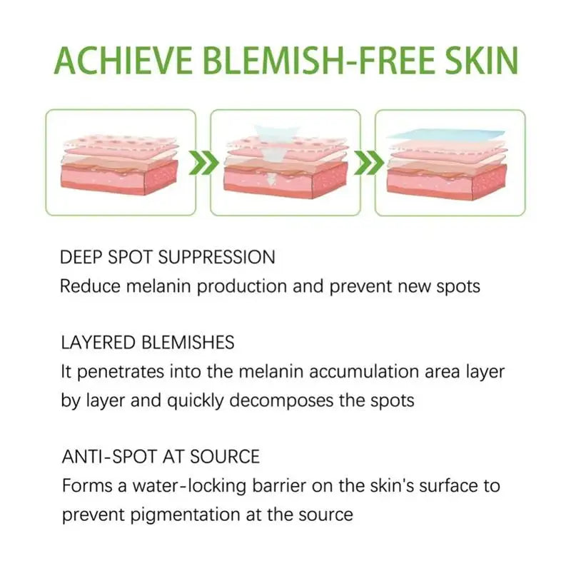 Powerful Spot-removing Whiten Cream Brighten Skin Fast Eliminates Melanin Pigmentation Melasma Dark Spots Moisturize Beauty Gel