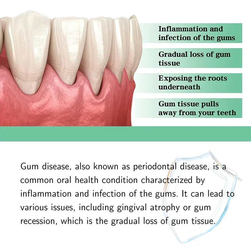 Gum Repair Drops Relieve Receding Gingival Swelling Gum Cleaning Care Oral Periodontal Hygiene Remove Yellow Tartar 2024 New