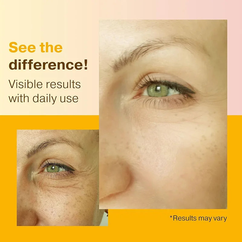 3pcs Vitamin C Wrinkle Remover Face Serum Lifting Firming Fade Fine Lines Anti-aging Essence Whitening Brighten Skin Care