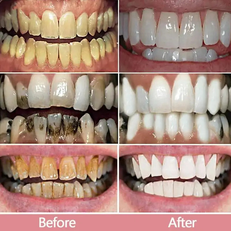 7 Day Teeth Whitening Toothpaste Remove Plaque Stains Deep Cleaning Oral Hygiene Bleaching Dental Tools Fresh Breath Tooth Care