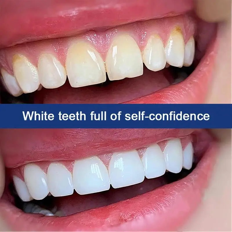 7 Day Teeth Whitening Toothpaste Remove Plaque Stains Deep Cleaning Oral Hygiene Bleaching Dental Tools Fresh Breath Tooth Care