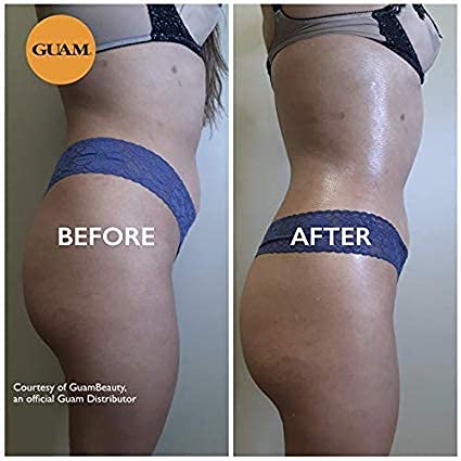 GUAM Anti Cellulite Stomach Wraps, INFRARED Body Wrap for Flat Tummy, FIR Tummy Wrap Cellulite Remover, Belly Cellulite Treatment, Stomach Skin Firming and Tightening Body Mud (2.2LB)