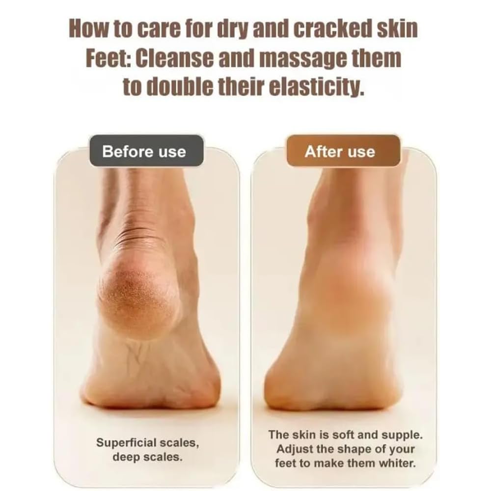 2025 New Electric Callus Remover for Feet, Portable Rechargeable Foot Repair and Grinding Device with Digital Display, Heel Polisher File for Men Women Dry Callus Dead Skin (Black)