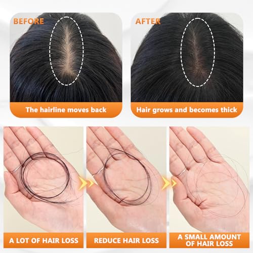 Anti Hair Loss Shampoo - Routine Shampoo for Women Hair Loss, Hair Fall Shampoo Promotes Hair Growth (1pcs)