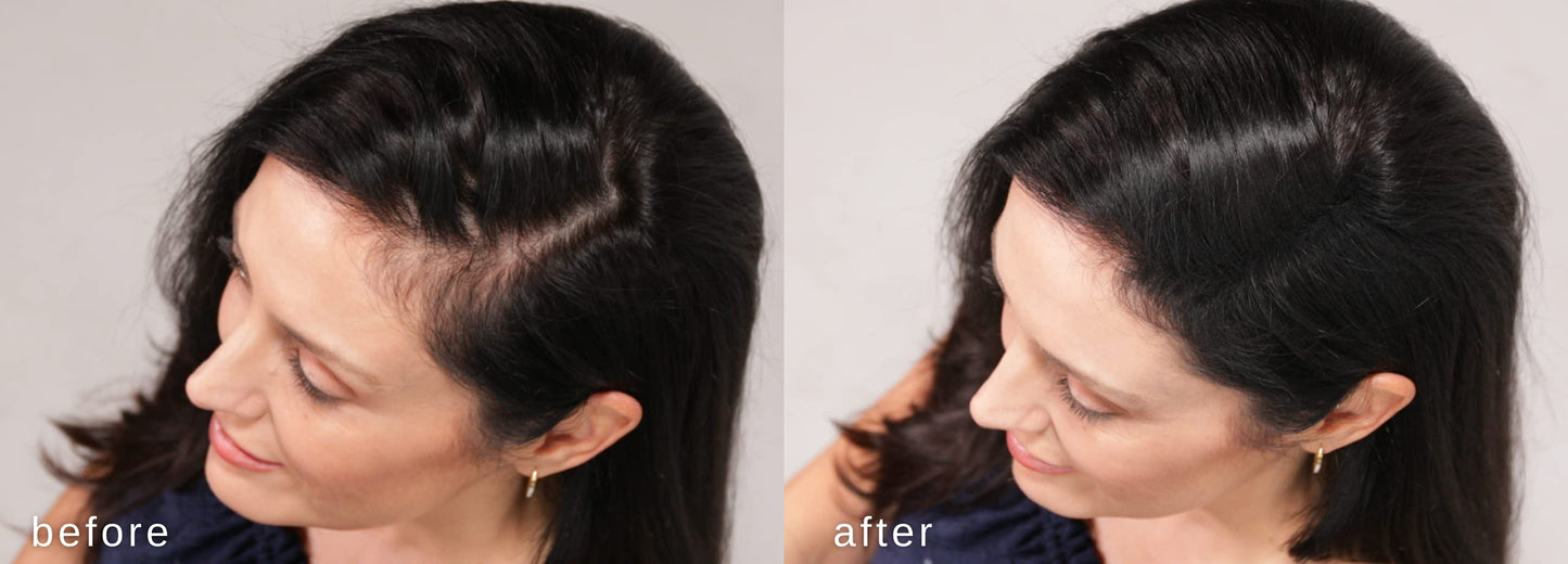 LUXE Hair Thickening Fibers for Unisex, CONFIDENCE IN A JAR, 2 Months+ Supply. Hypoallergenic, Dermatologist Tested, Multiple Colors Available (Black)
