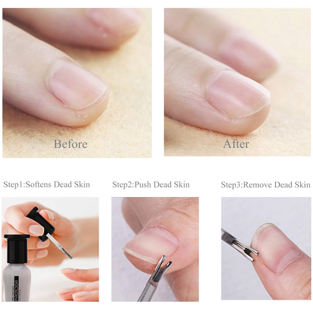 6PCS Cuticle Pusher Set, Stainless Steel Cuticle Remover Kit, Cutter and Trimmer Manicure and Pedicure Tools for Fingernail and Toenails