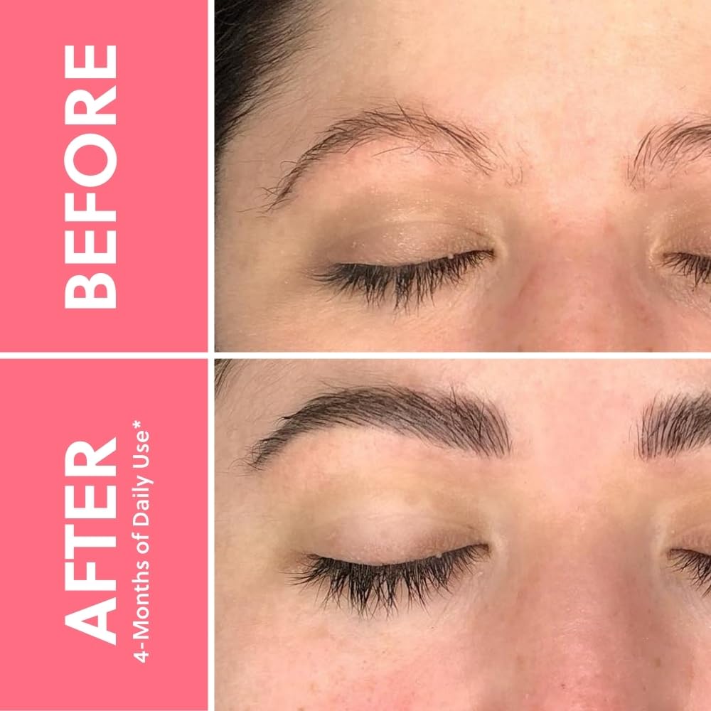 Lash & Brow Growth Bundle – Hormone-Free Enhancer for Longer Lashes & Fuller Brows – Vegan, Natural & Gentle Serum Duo for 24/7 Nourishment & Strengthening [2x 0.10 fl. oz / 3ml]