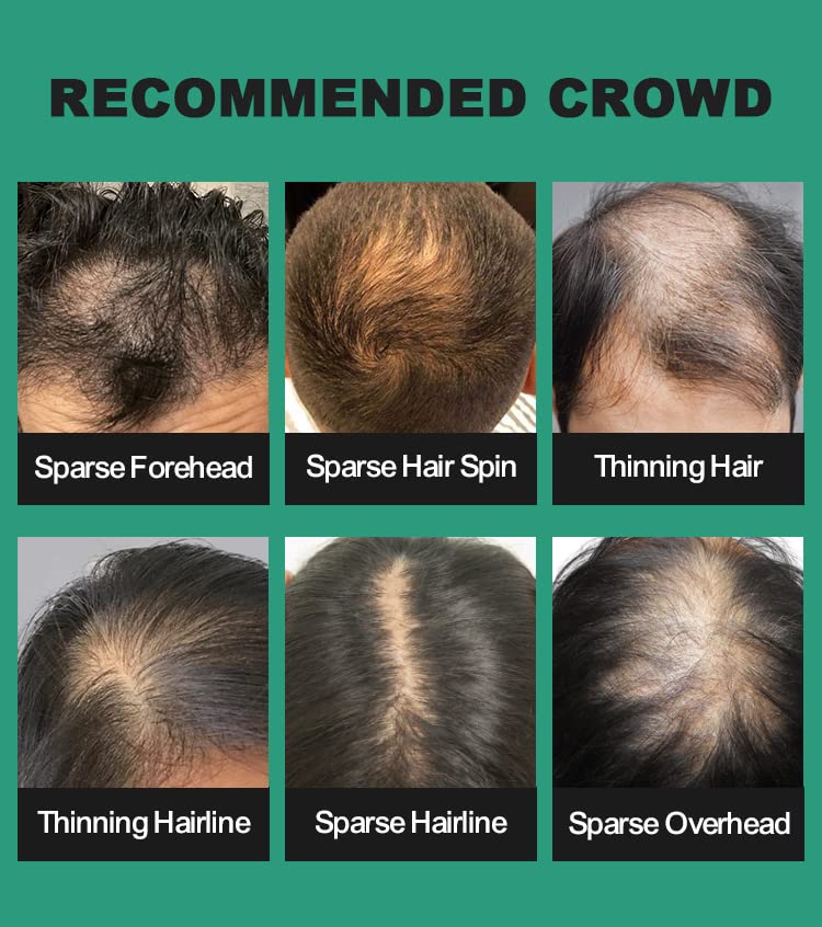 BLACK Hair Fibers for Thinning Hair 27.5g Bottle with Applicator | Undetectable & Natural Keratin Hair Fibers Concealer for Hair Loss for Men and Women | Hair Building Fibres Powder [BLACK Hair Fiber]