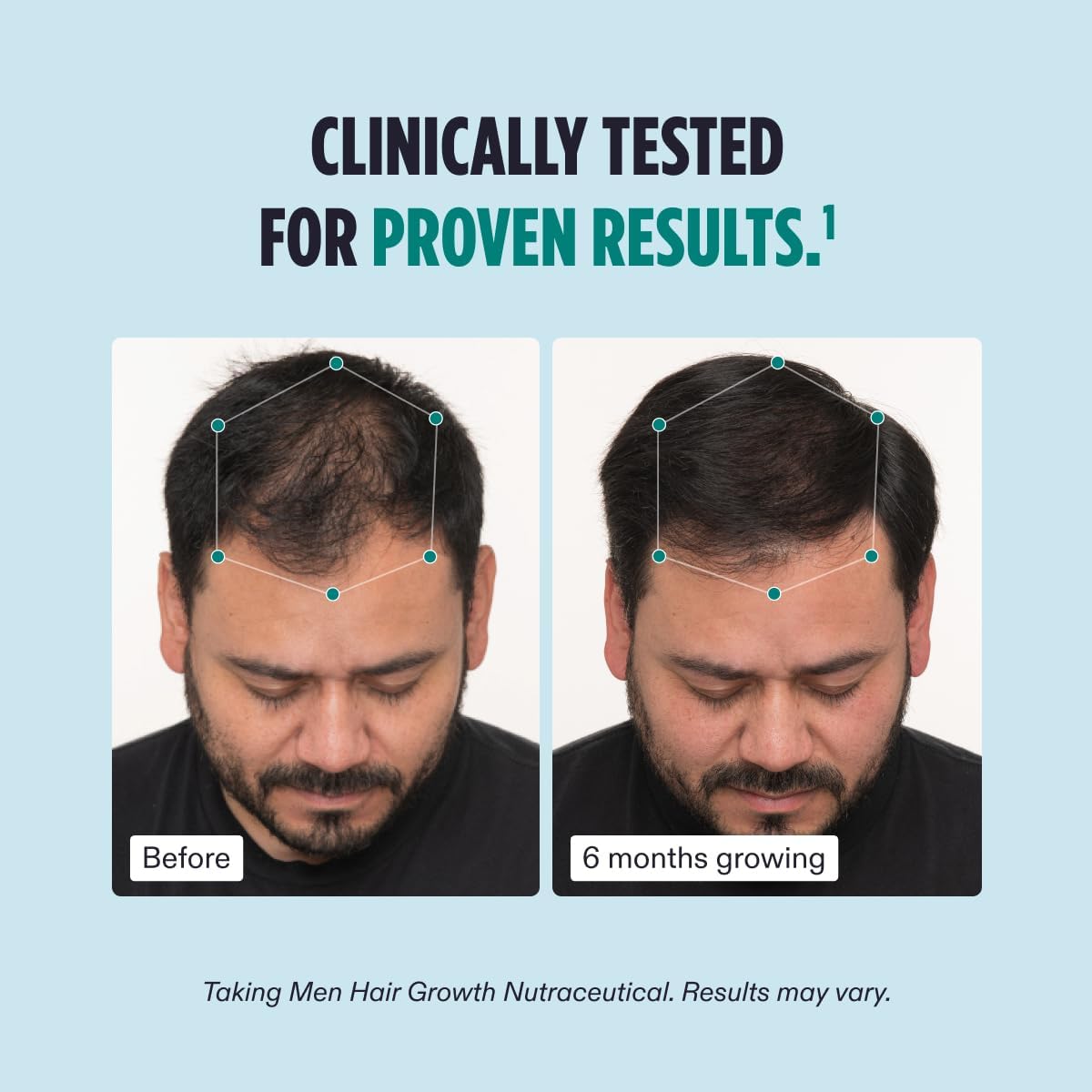Nutrafol Men's Hair Growth Supplement and Hair Serum, Clinically Tested for Visible Thickness and Strength - 1 Month Supply, 1.7 Fl Oz Bottle