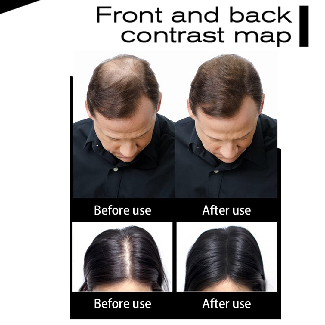 Hair Fibers Hair Building Fibers 100% Undetectable Hair Fuller Thicker,Instantly Cover Sparse Hair 25g/0.88oz (gold)