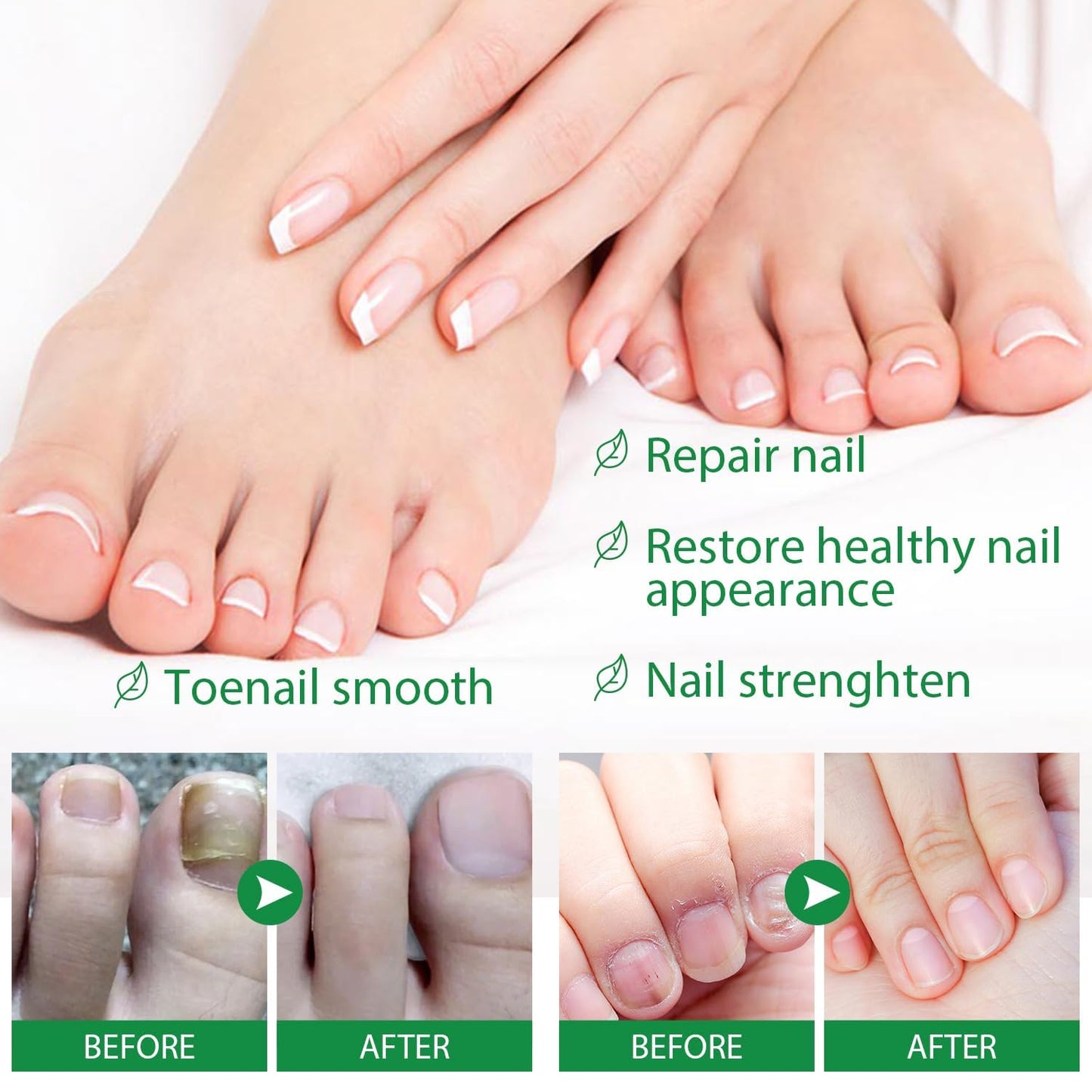 Ginger Nail Treatment Nail Growth Serum, Ginger Nail Growth Oil for Damaged Nails - Repair and Strengthen for Glowing, Beautiful Nails 30ML / 1.06OZ (1 PCS)