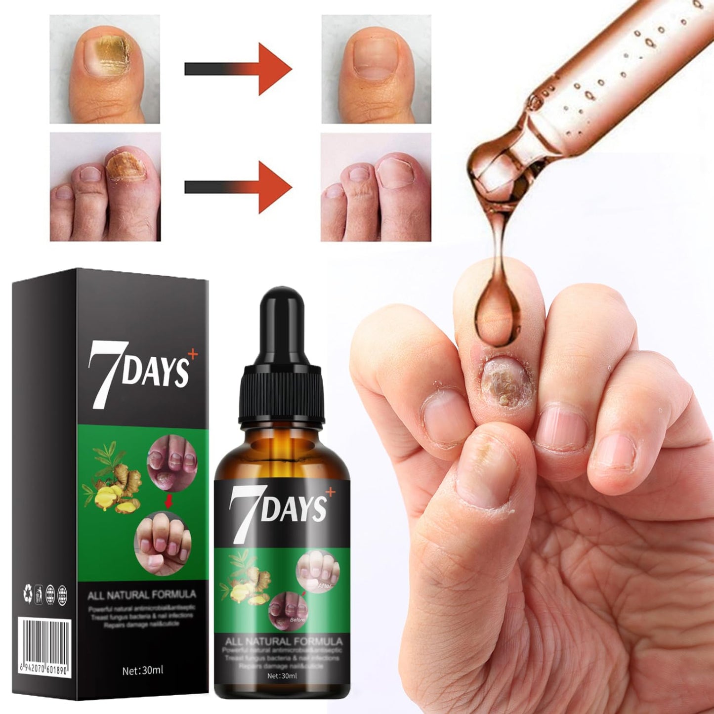 Ginger Nail Treatment Nail Growth Serum, Ginger Nail Growth Oil for Damaged Nails - Repair and Strengthen for Glowing, Beautiful Nails 30ML / 1.06OZ (1 PCS)