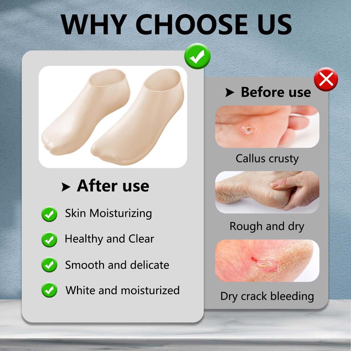 2 Pair Silicone Moisturizing Socks Gloves Set, Gel Socks for Dry Cracked Feet Women Men, Lotion Aloe Spa Pedicure Socks for Foot Softening Care, Silicone Hand and Feet Gloves (Nude)