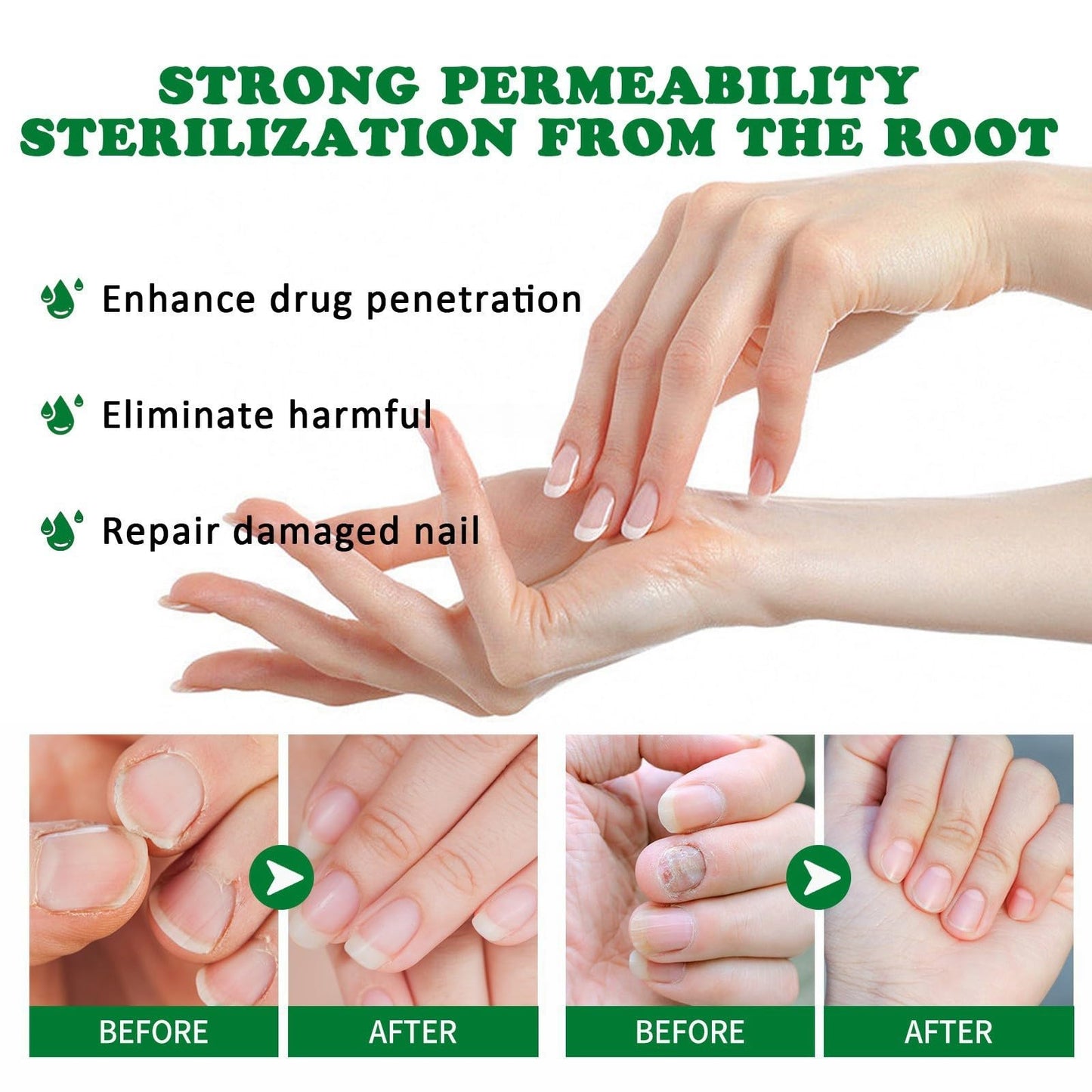 7 Days Ginger Foot Spray, 7 Days Nail Repair, 7 Days Ginger Nail Treatment, Ginger Nail Treatment (3pcs)