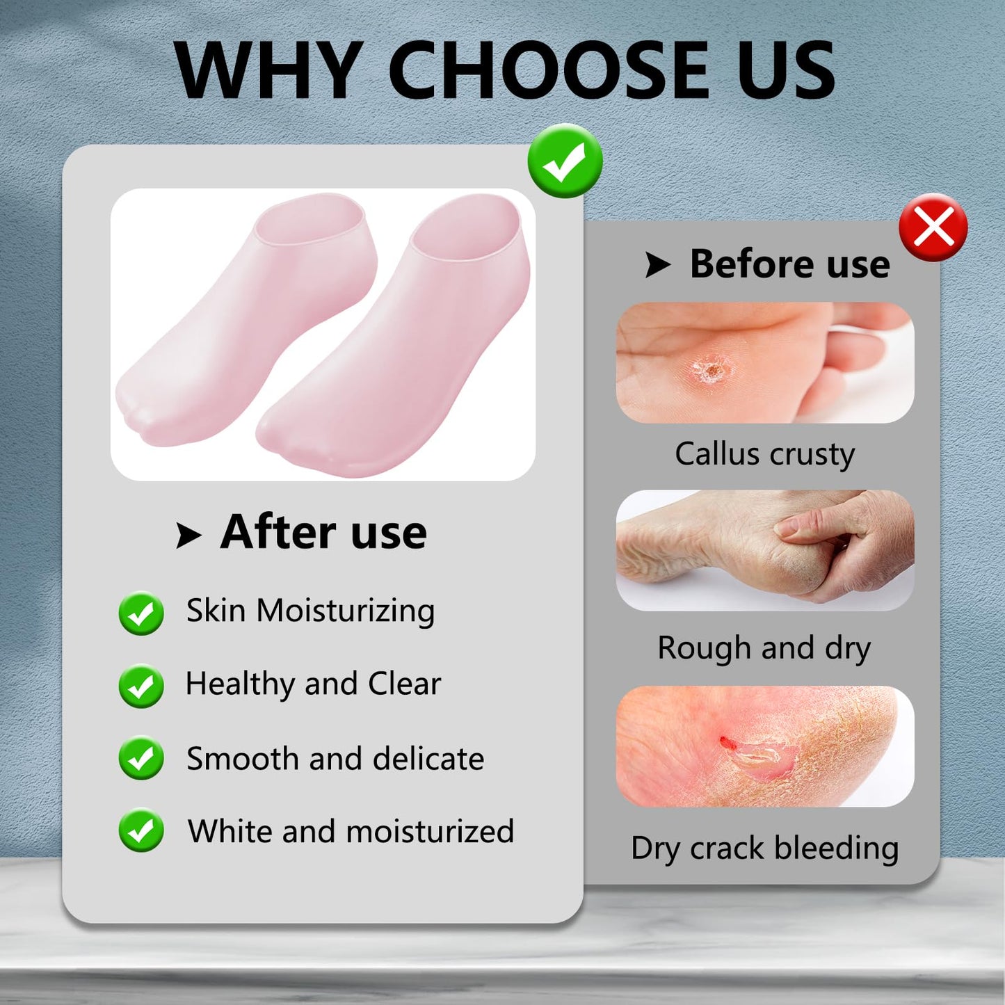2 Pair Silicone Moisturizing Socks Gloves Set, Gel Socks for Dry Cracked Feet Women Men, Lotion Aloe Spa Pedicure Socks for Foot Softening Care, Silicone Hand and Feet Gloves (Pink)