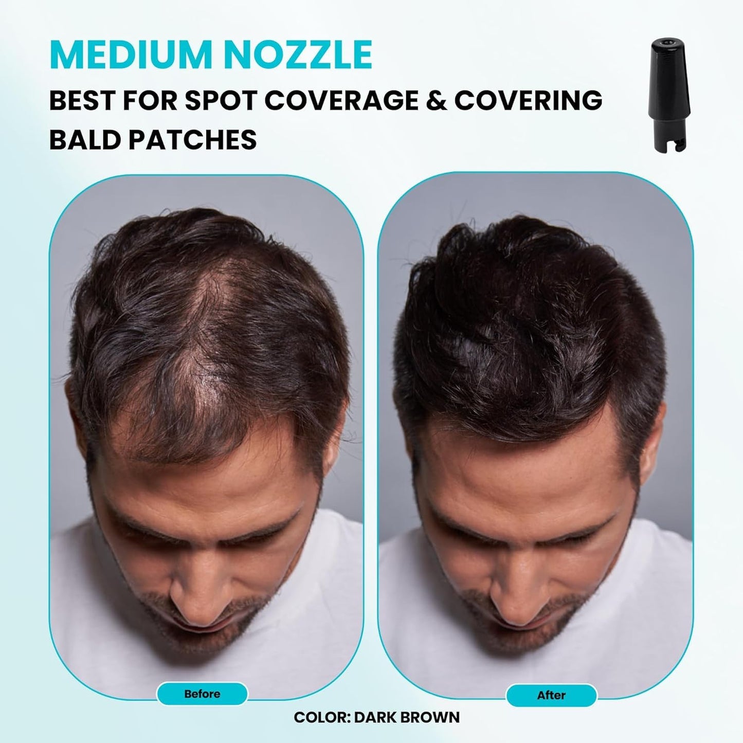 Hair Building Fibers, 15G, with BONUS Pump Applicator, Hairline Comb and 3 Nozzles, Hair and Hairline Filler Kit For Men and Woman (Auburn)