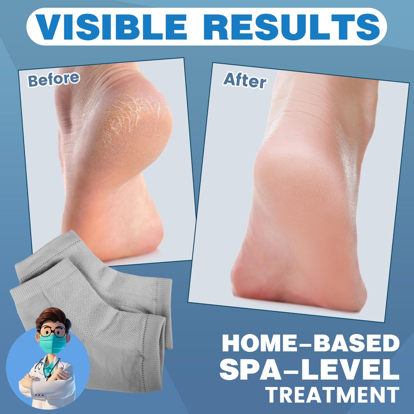 TEAWOO 3 Pairs Moisturizing Heel Socks for Cracked Heel Treatment, Foot Care Toeless Socks to Soften and Hydrate Dry Cracked Feet Heels, Cracked Heel Repair Socks, Gel Socks for Dry Cracked Feet
