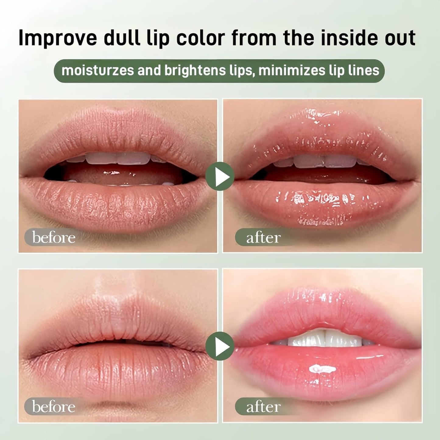 2 PCS Summer Lip Butter Balm,Conditioning Lip Gloss Lip Balm for Instant Moisture, Soothing Lip Care, Lip Oil Softens Dry Lips (Poppy)