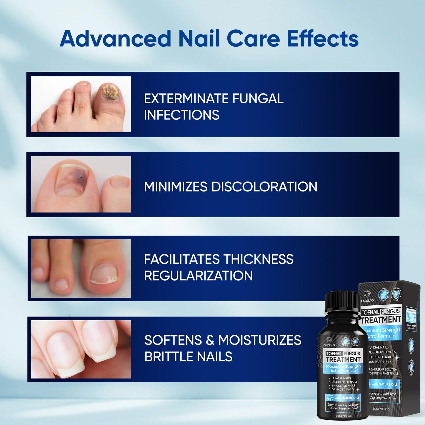 Toenail Fungus Treatment, Nail Fungus Treatment for Toenail, Toe Nail Fungus Treatment Extra Strength for Woman and Man, Nail Fungus Treatment 30ML (1 FLOZ)