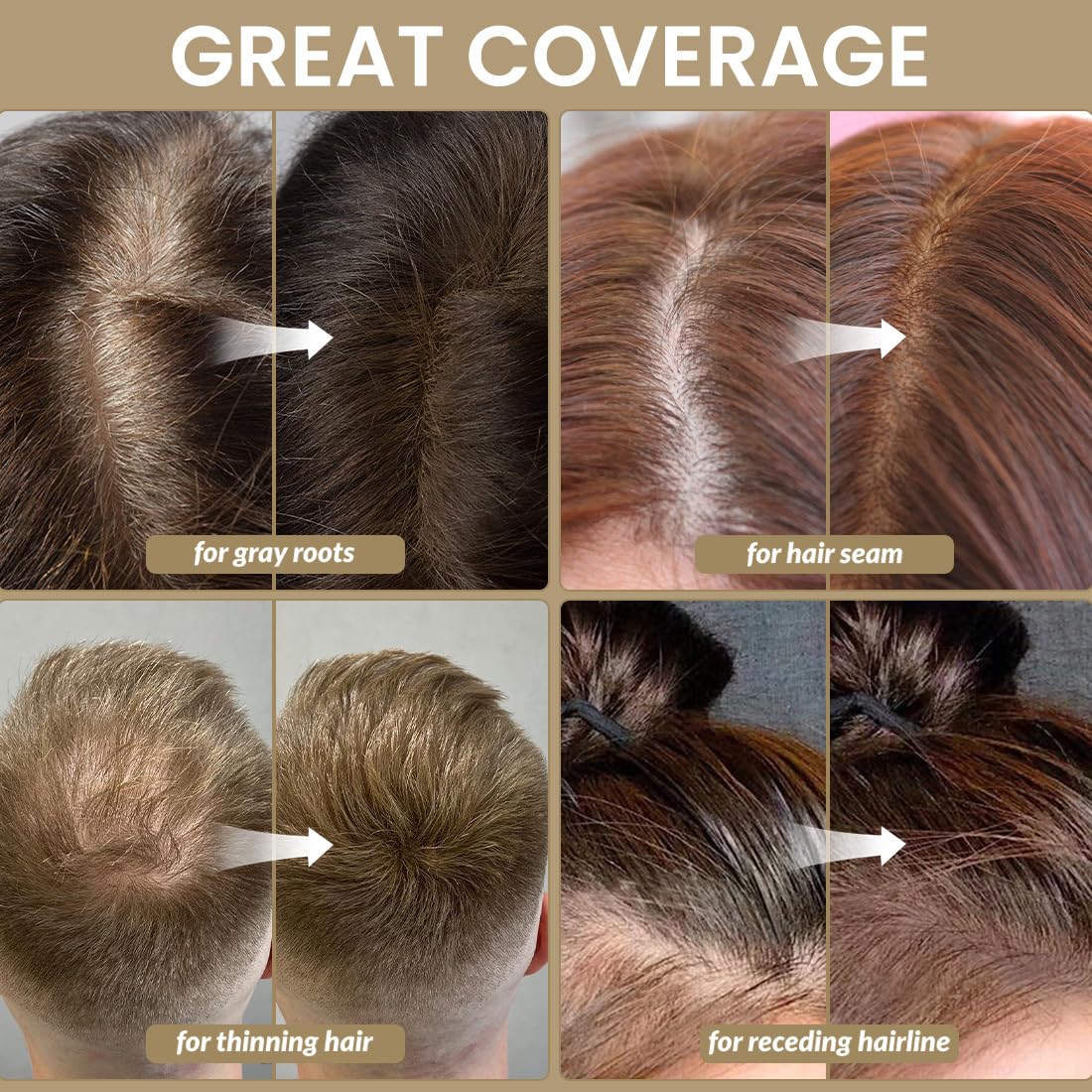 VOLLUCK Root Touch up Powder, Instant Hairline Powder for Thinning Areas and Gray Hair Coverage, Natural and Non-greasy Root Cover up for Women and Men (Gray, 0.14 Ounce)
